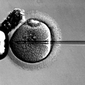 Fertilização in vitro Fertilização in vitro