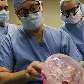 Equipe de médicos olha para um modelo do rosto de Connie durante a cirurgia
