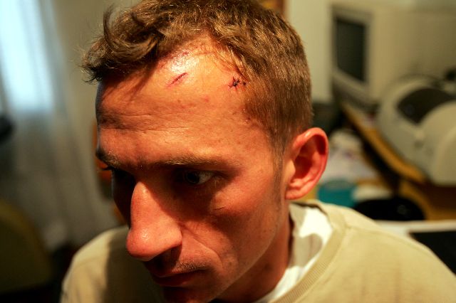 Adestrador é agredido por motorista