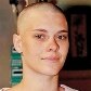 Veja mulheres que ficaram carecas em prol da arte 