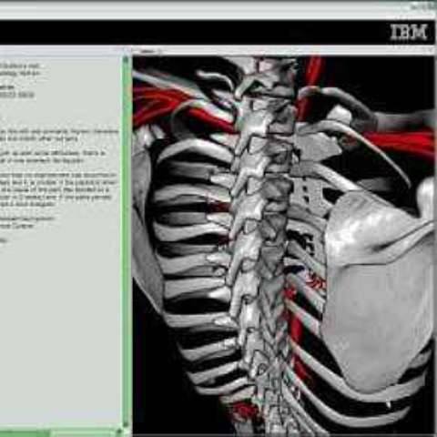 Software da IBM funciona como Google Earth do corpo humano. 26/9/2007