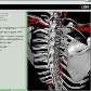 Software da IBM funciona como Google Earth do corpo humano. 26/9/2007