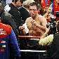 De La Hoya com o olho machucado após a luta