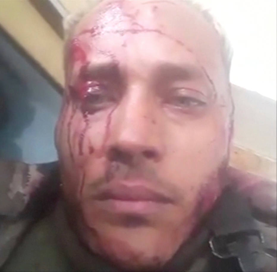 Dans les vidéos publiées sur Instagram pendant le siège de la police, Oscar Pérez semble ensaguentado visage et accuse les forces de sécurité de vouloir le tuer