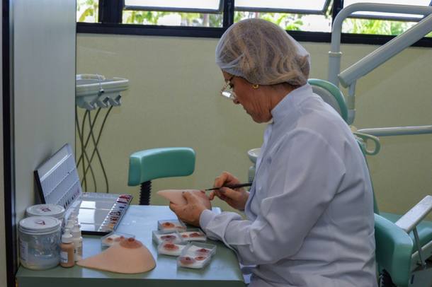 Próteses da Univap já beneficiaram dez mulheres no Vale do Paraíba
