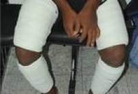 Diversas formas de esconder drogas em flagrantes feitos pela PF neste ano em Cumbica. Na foto, cocaína é levada nas pernas.