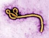 A doença causada pelo vírus Ebola (EVE) é grave e pode ser mortal. O vírus é transmitido ao ser humano por animais selvagens e se propaga nas populações humanas por transmissão de pessoa a pessoa.