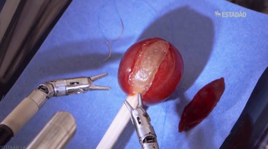 Profissões do Futuro: cirurgia robótica