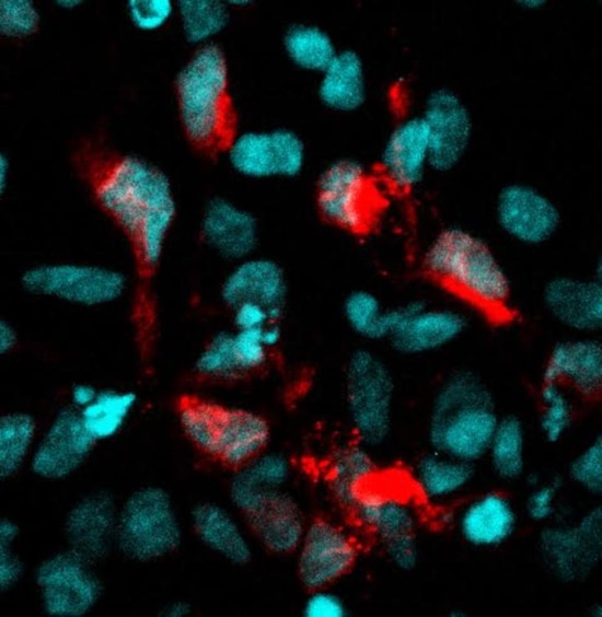 Núcleo de célula-tronco neuronal infectada com o vírus zika, em vermelho. Imagem obtida em pesquisa do grupo de Stevens Rehen