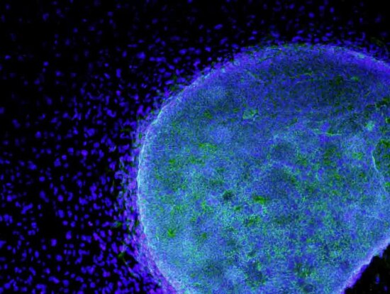 CIRM Outro emprego impressionante - e potencialmente preocupante - é criação de genes capazes de se espalhar rapidamente numa população, passando por cima das restrições impostas pela seleção natural