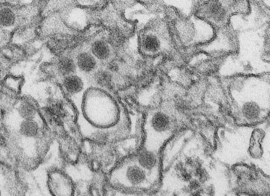 O vírus zika é recente e foi inicialmente identificado em Uganda, em 1947, em macacos. Posteriormente, foi identificado em seres humanos, em 1952, em Uganda e na República Unida da Tanzânia. Surtos da doença são registrados na África, Américas, Ásia e no Pacífico.