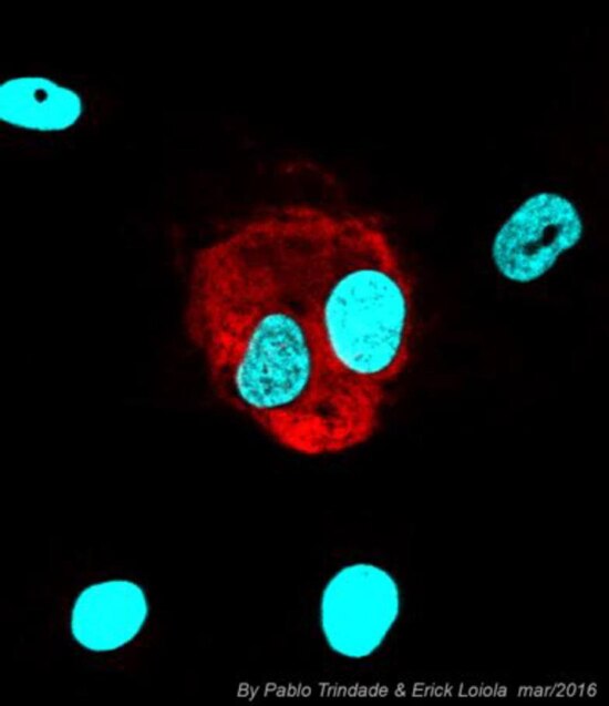 Núcleo de célula-tronco neuronal infectada com o vírus zika, em vermelho. Imagem obtida em pesquisa do grupo de Stevens Rehen