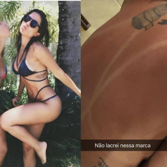 Reprodução/Snapchat A cantora Aniita mostrou em seu snapchat o resultado de um dia de sol com o biquíni de tiras.