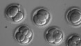 Cientistas conseguem editar genoma de embrião humano para evitar doença hereditária