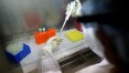 Universidade de Nevada confirma caso de reinfecção de coronavírus em paciente de 25 anos
