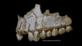 DNA de placa nos dentes revela que Neanderthal usava 'aspirina'