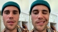 Síndrome de Ramsay Hunt: Entenda a condição que paralisou o rosto de Justin Bieber