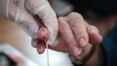 Hepatite misteriosa em crianças: Indonésia reporta três mortes e EUA investigam óbito