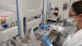 Laboratório brasileiro desenvolve teste de coronavírus