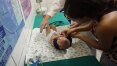Mãe de bebê com microcefalia teme ter de deixar emprego