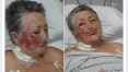 Enfermeiro é afastado após suspeita de agressão contra idosa de 78 anos em SP
