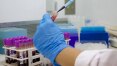 Epidemia de zika revela ciência forte no País e falta de recursos