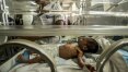 Unicef denuncia ‘claros sinais’ de elevada desnutrição entre crianças na Venezuela