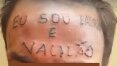 Internautas fazem ‘vaquinha’ online para pagar remoção de menino torturado por tatuador