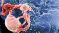 Vacina contra HIV apresenta resultados 'encorajadores', dizem cientistas