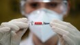 Secretário de Saúde reforça pedido por vacinação de atrasados, mas descarta exigir máscaras