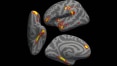 Covid-19 pode causar encolhimento do cérebro e perda de memória, mostra estudo