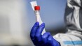 Ministério da Saúde avalia ampliar protocolo e testar para covid-19 quem apresenta sinais de gripe