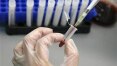 Vacina contra HIV será testada no Brasil e pode estar disponível em 4 anos