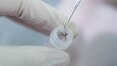 Tratamento com injeção de vírus zika destrói tumor cerebral em roedor sem causar lesão neurológica