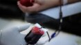 PSB vai ao Supremo contra discriminação a homossexuais em doação de sangue