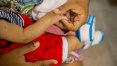 Estado do Rio confirma 36 bebês com microcefalia com sugestão de zika