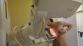 EUA recomendam mamografia anual a partir dos 45 anos