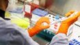 Varíola dos macacos: até fim de agosto laboratórios públicos farão diagnóstico, diz ministro