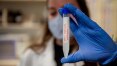 UFPR lança campanha de doações para desenvolver vacina contra a covid-19
