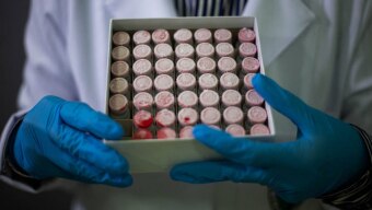 Exame molecular indicou que paciente estava infectado com Covid-19; fabricada a partir de vírus inativados, vacina do Instituto Butantan não é capaz de provocar a doença; Foto: Wilton Junior/Estadão