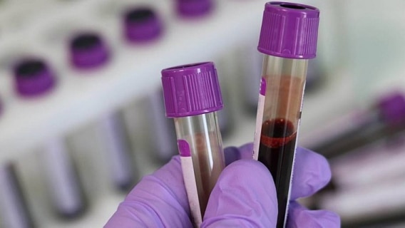 Conforme a OMS, a hepatite é uma inflamação que atinge o fígado causada por uma variedade de vírus infecciosos (hepatite viral) e agentes não infecciosos. Foto: Pixabay