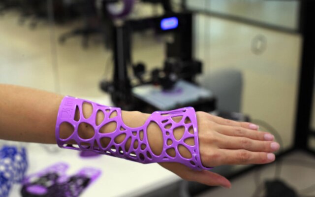 A peça de imobilização da startup Fix It é feita a partir de impressão em 3D