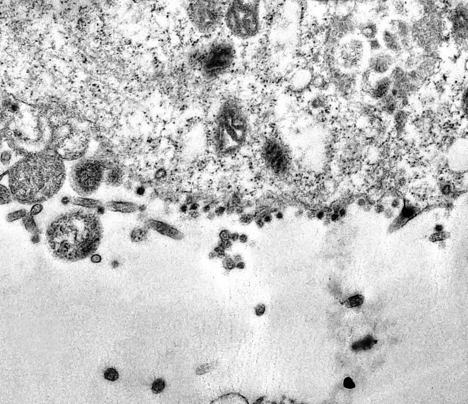 Imagem ampliada exibe partículas do vírus (pontos escuros) aderidas à membrana da célula 