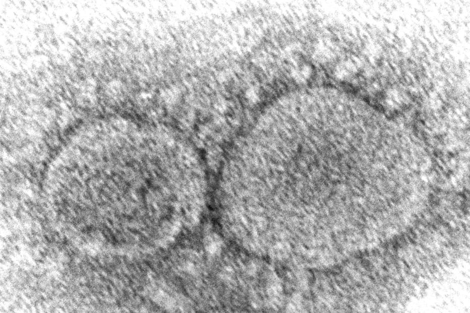 Imagem feita por pesquisadores do vírus da covid-19 