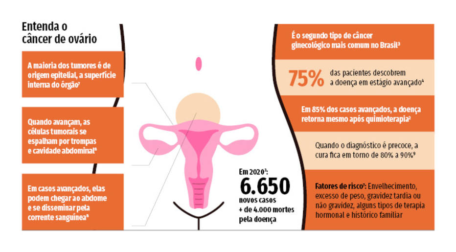 Câncer de Ovário: o que é, tipos, epidemiologia e mais! - Sanar Medicina