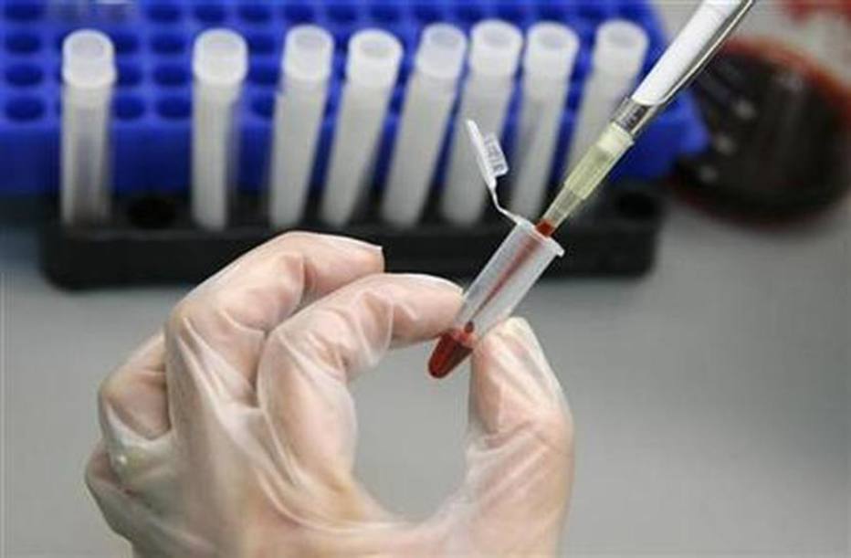 Porque é Difícil Conseguir Uma Vacina Contra A Aids