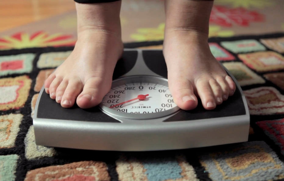 Sobrepeso na adolescência representa risco cardíaco equivalente ao da obesidade