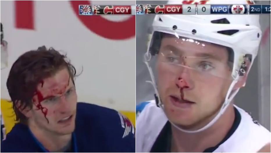 Hóquei: Briga termina com jogador com a cabeça sangrando