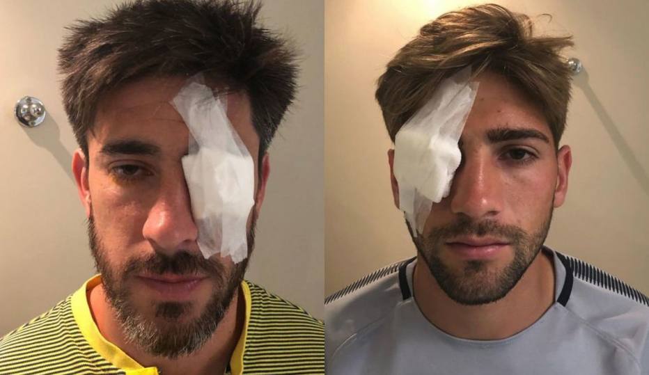 PÃ©rez e Lamardo tiveram ferimentos no olho