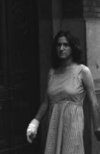 A estudante Graziela Augusta Eugênia, queimada pelas bombas da polícia, durante a invasão da PUC, 10/10/1977